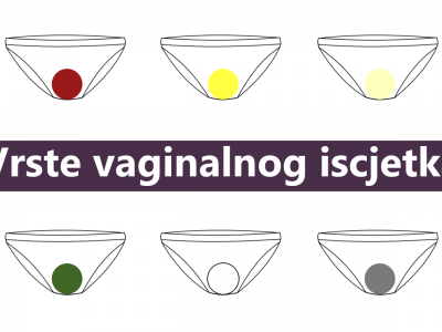 Što nam govori vaginalni iscjedak